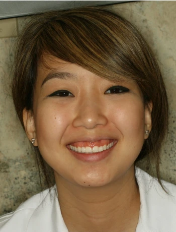 Smiling young woman with light brown hair and eyeliner, wearing small earrings and a white top.