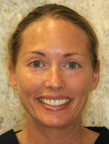 Smiling woman with light brown hair pulled back, green eyes, and clear skin in front of a marbled background.