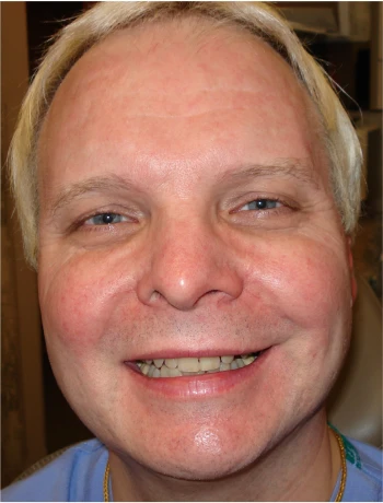 Close-up of a smiling man with light skin, blond hair, and blue eyes.