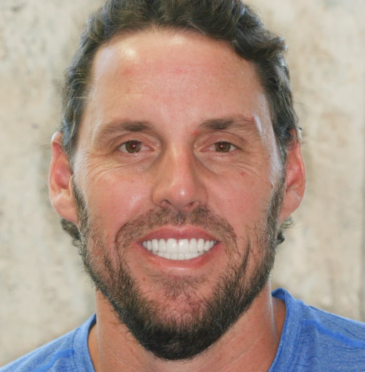 Close-up of a man with short dark hair, a beard, and a bright smile wearing a blue shirt.