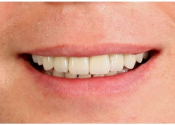 Close-up of a person smiling showing white teeth and pink lips.