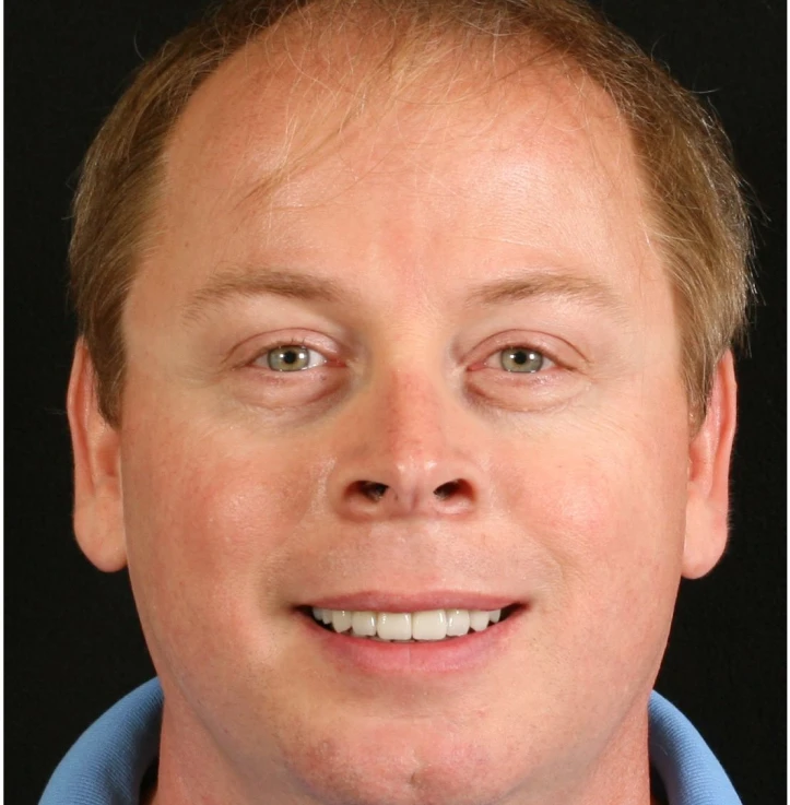 Close-up portrait of a smiling middle-aged man with light skin, green eyes, and short light brown hair wearing a blue collared shirt.
