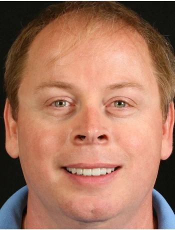 A close-up portrait of a smiling man with light skin, short light brown hair, and green eyes wearing a blue collared shirt.