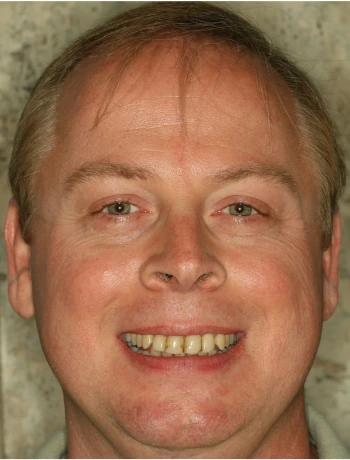 Close-up of a smiling middle-aged man with light hair and light skin against a neutral background.