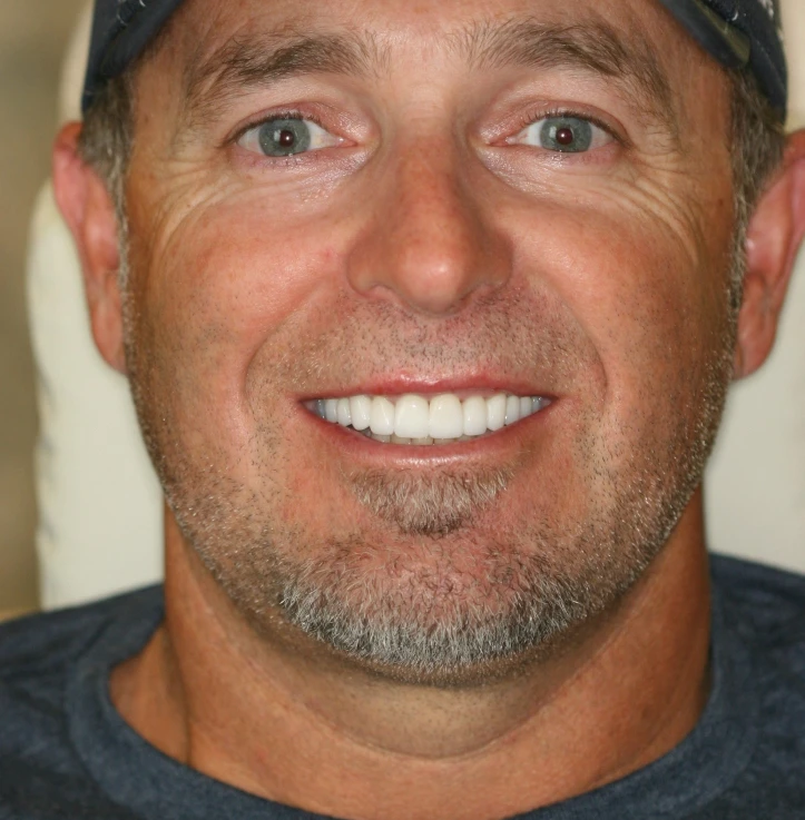 Close-up of a smiling middle-aged man with light stubble and a small goatee, wearing a dark blue shirt and a cap.