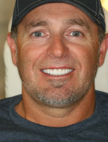 Close-up of a smiling man with light facial stubble wearing a dark cap and blue shirt.