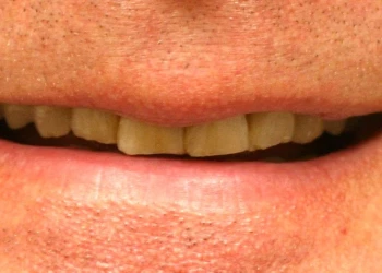 Close-up of a person's mouth with slightly parted lips showing upper teeth.