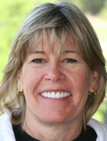 Smiling woman with short blonde hair wearing gold hoop earrings and a black and white top.
