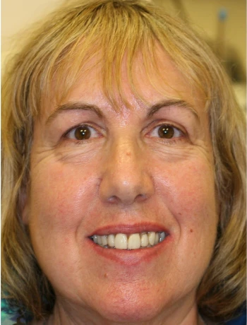 Close-up portrait of a smiling middle-aged woman with short blonde hair and brown eyes.