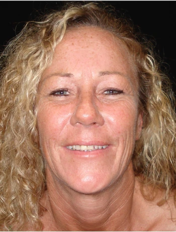Smiling middle-aged woman with curly blonde hair against black background.