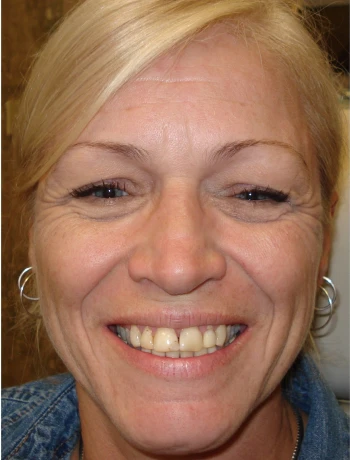 Close-up of a smiling middle-aged woman with short blonde hair and hoop earrings.