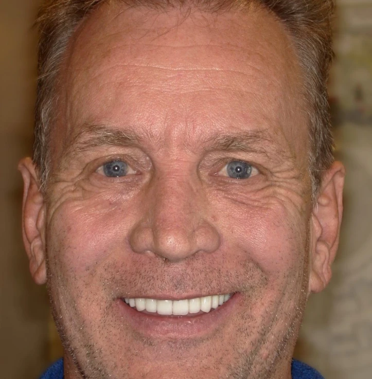 Close-up of a middle-aged man with blue eyes and short brown hair smiling broadly, showing white teeth.