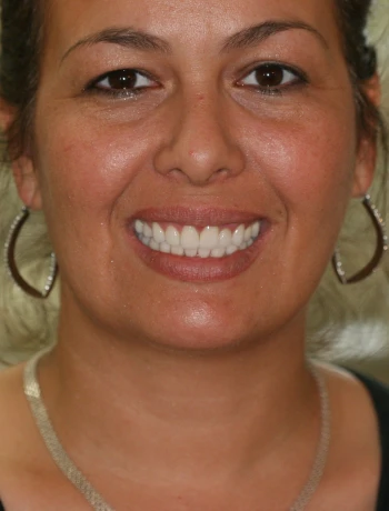 Close-up of a smiling woman with hoop earrings and a necklace.