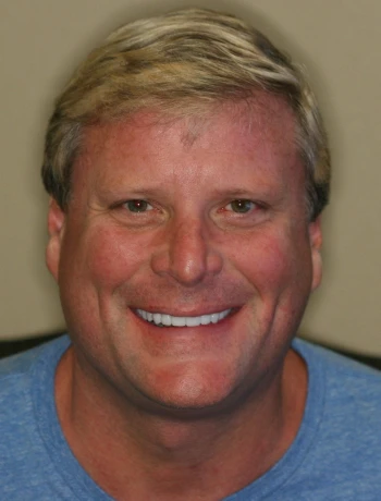 Smiling middle-aged man with blond hair wearing a blue shirt against a neutral background.