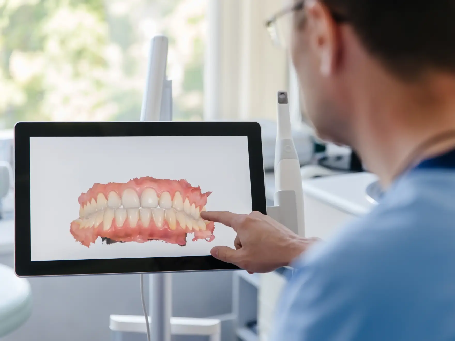 Dentist pointing at a digital 3D model of teeth displayed on a screen in a dental office.
