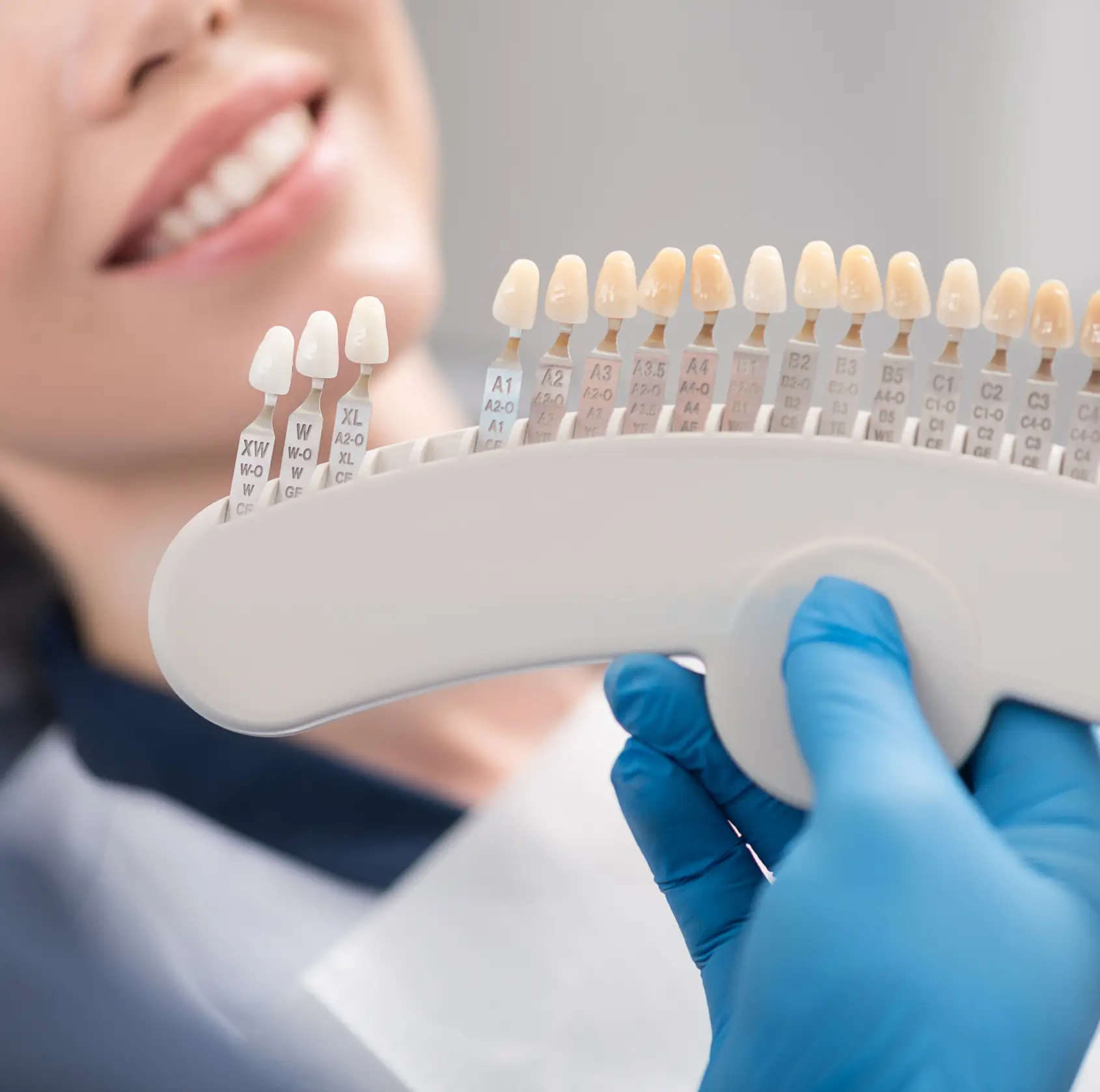 Dental professional holding a shade guide near a smiling patient's teeth for color matching.