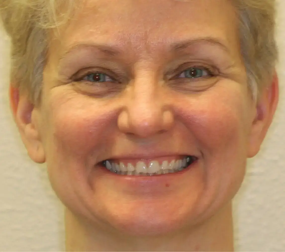 Close-up of a smiling middle-aged woman with short blonde hair and light skin.