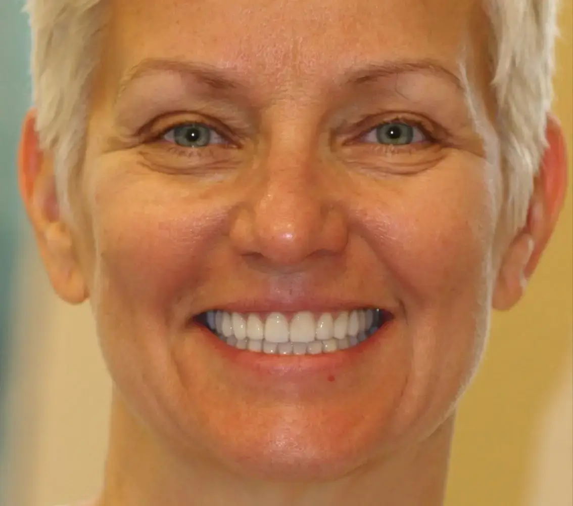 Close-up of a smiling middle-aged woman with short blonde hair and bright white teeth.