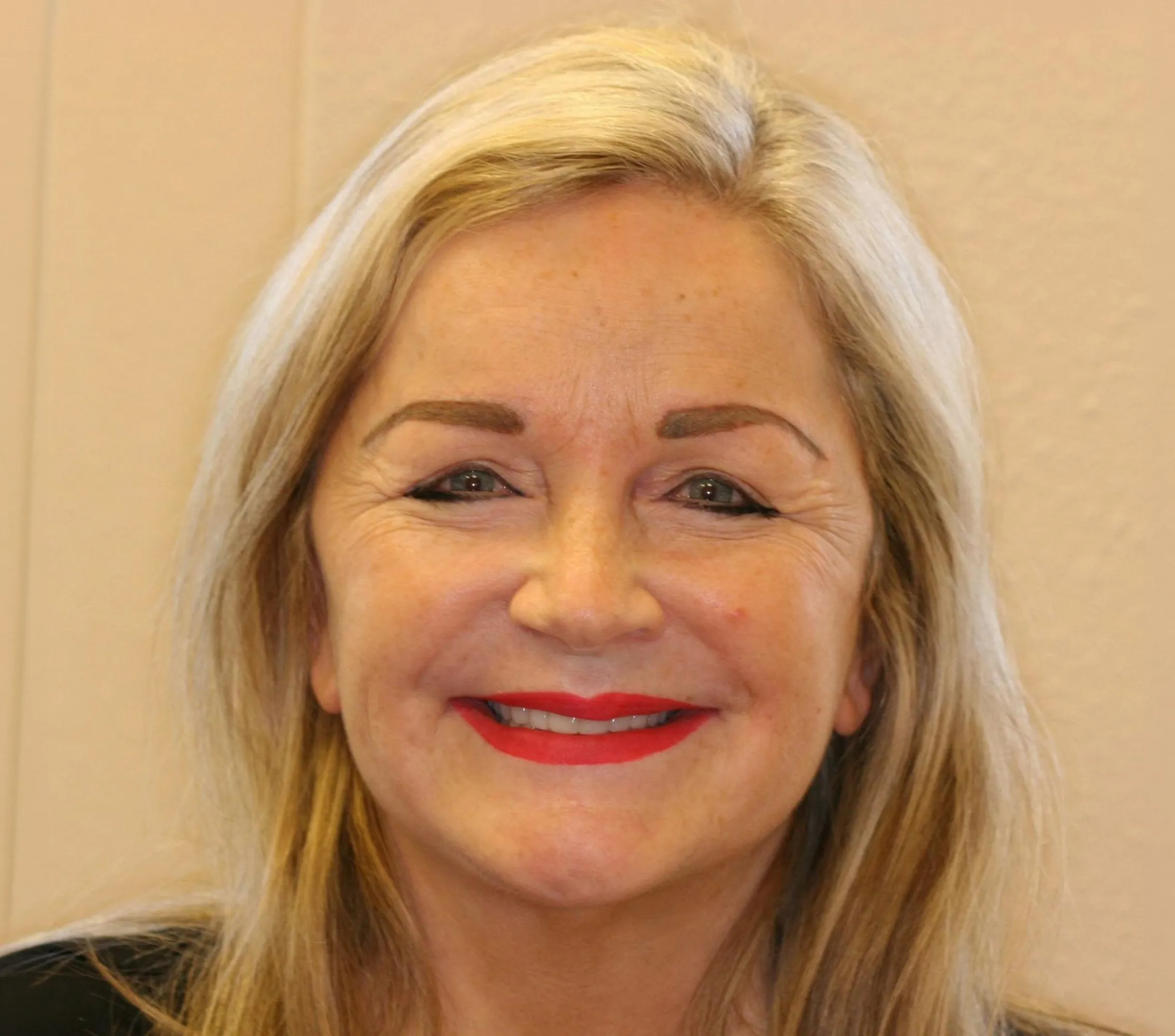 The Smile Lift - YuvaLift™ before