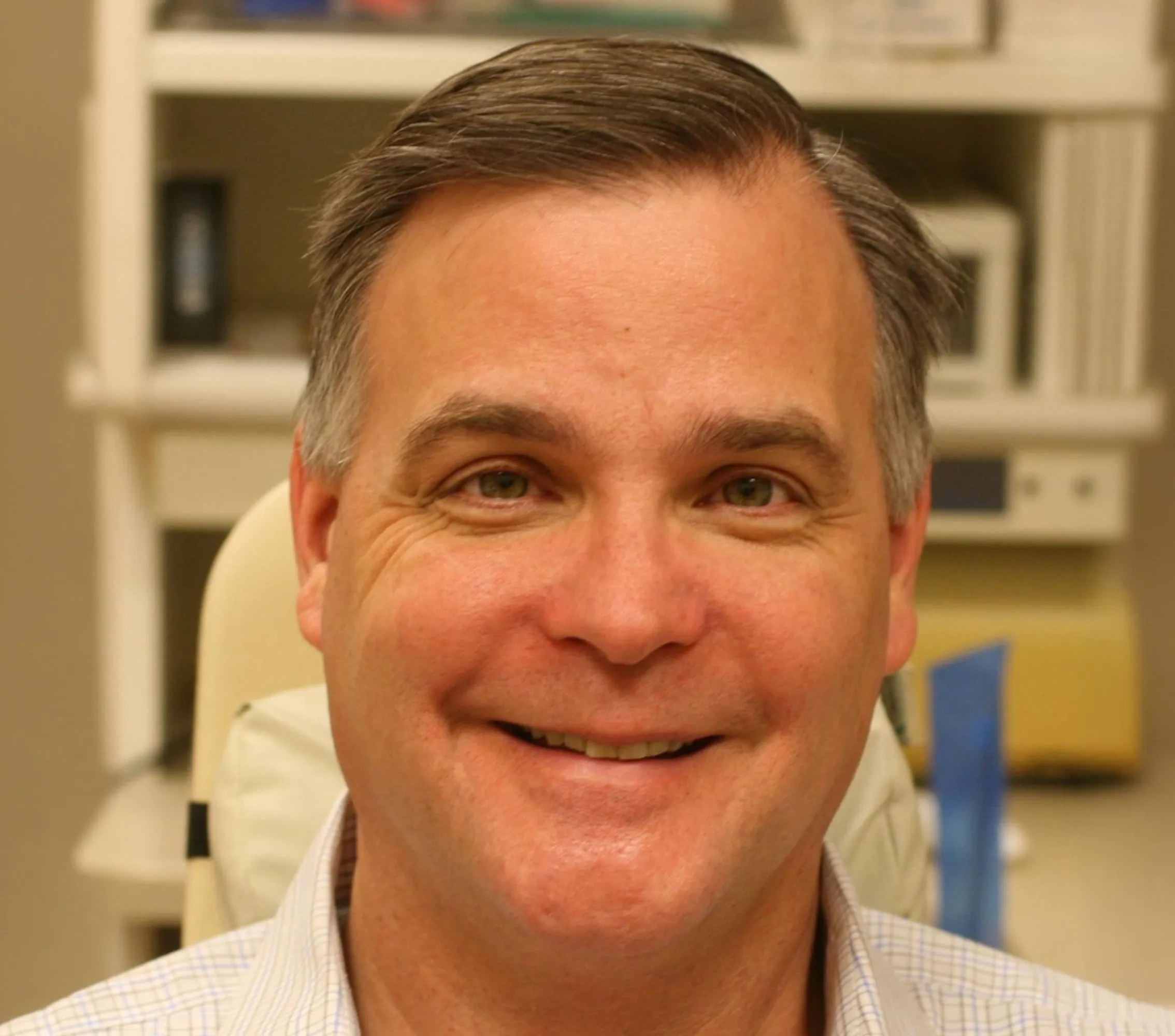 The Smile Lift - YuvaLift™ before