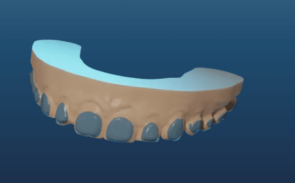 3d rendering orthodontic lab software
