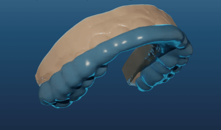orthodontic lab software mouth guard 3D rendering