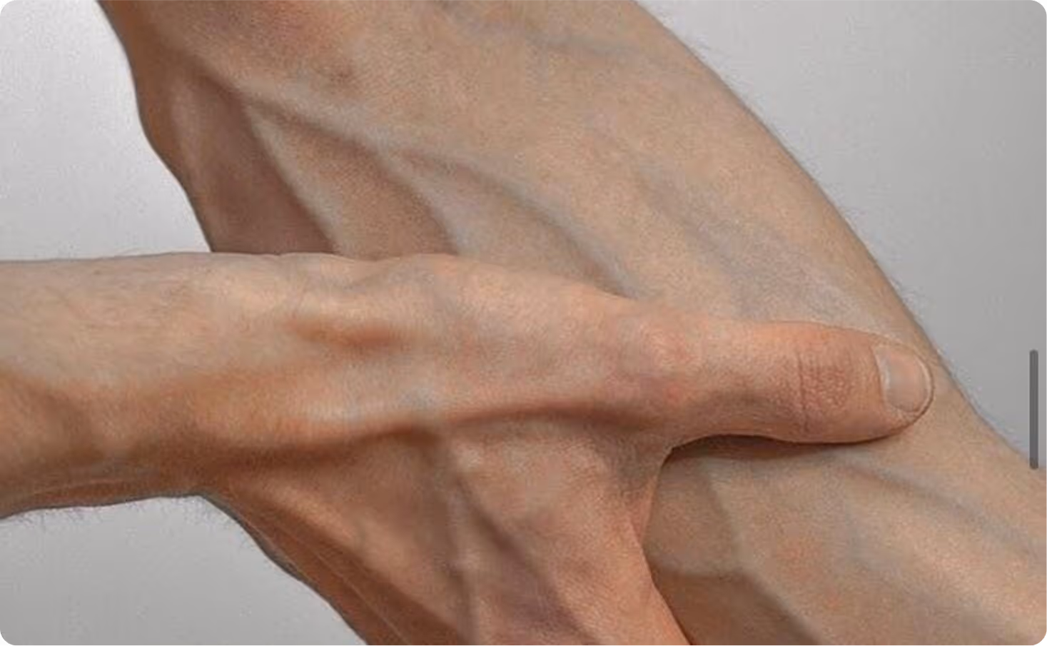 Main touchant un bras avec réseau veineux visible, lumière naturelle