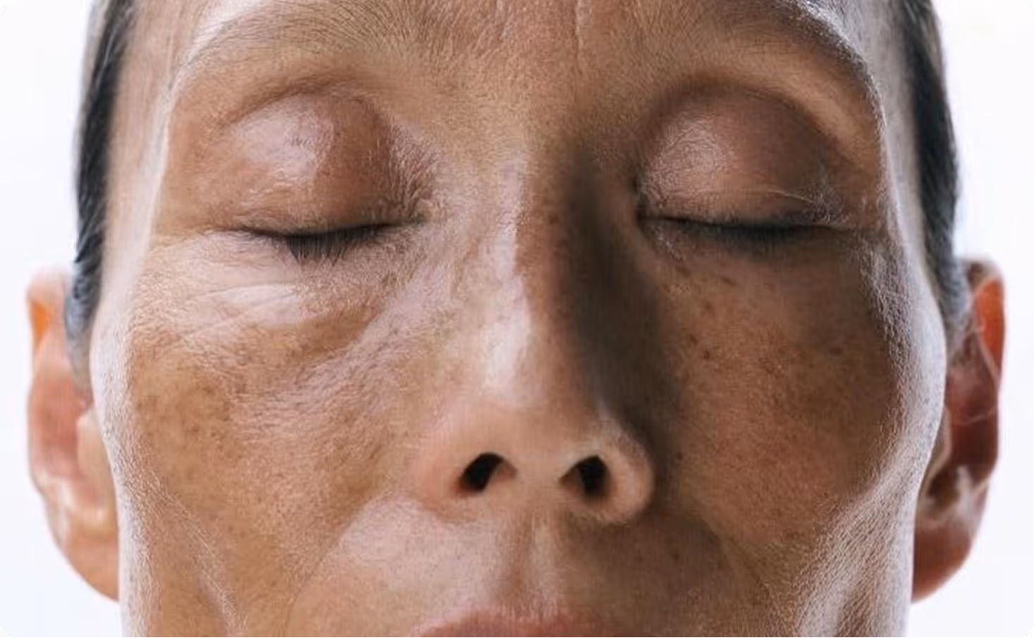 Femme aux yeux fermés, peau naturelle avec texture visible, en position détendue