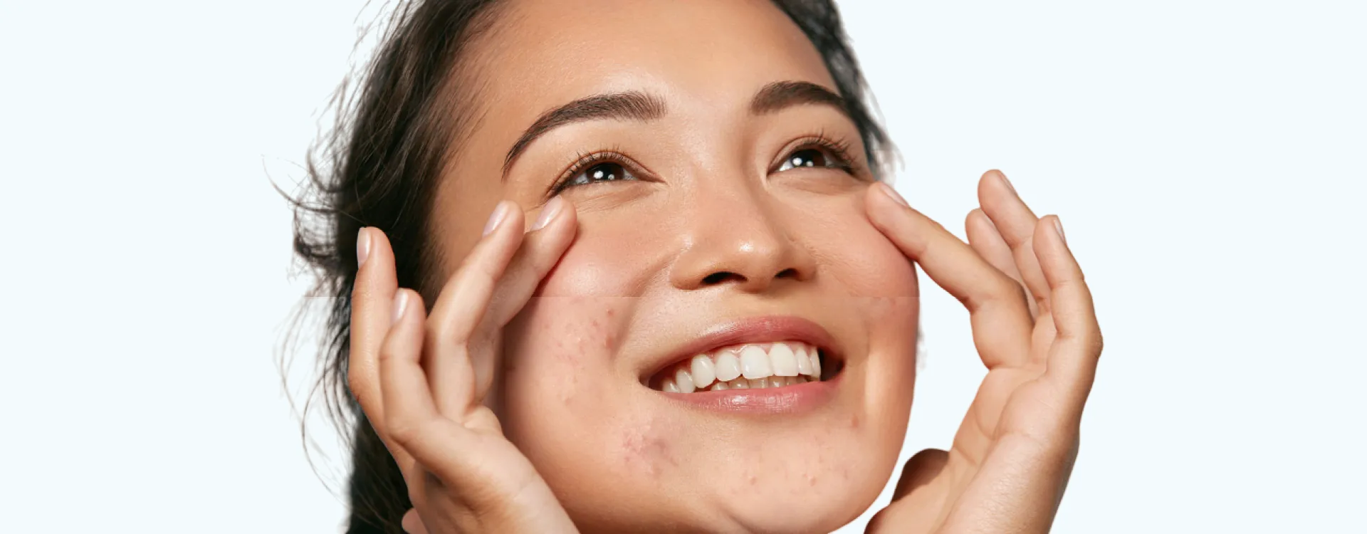 beauty product after before