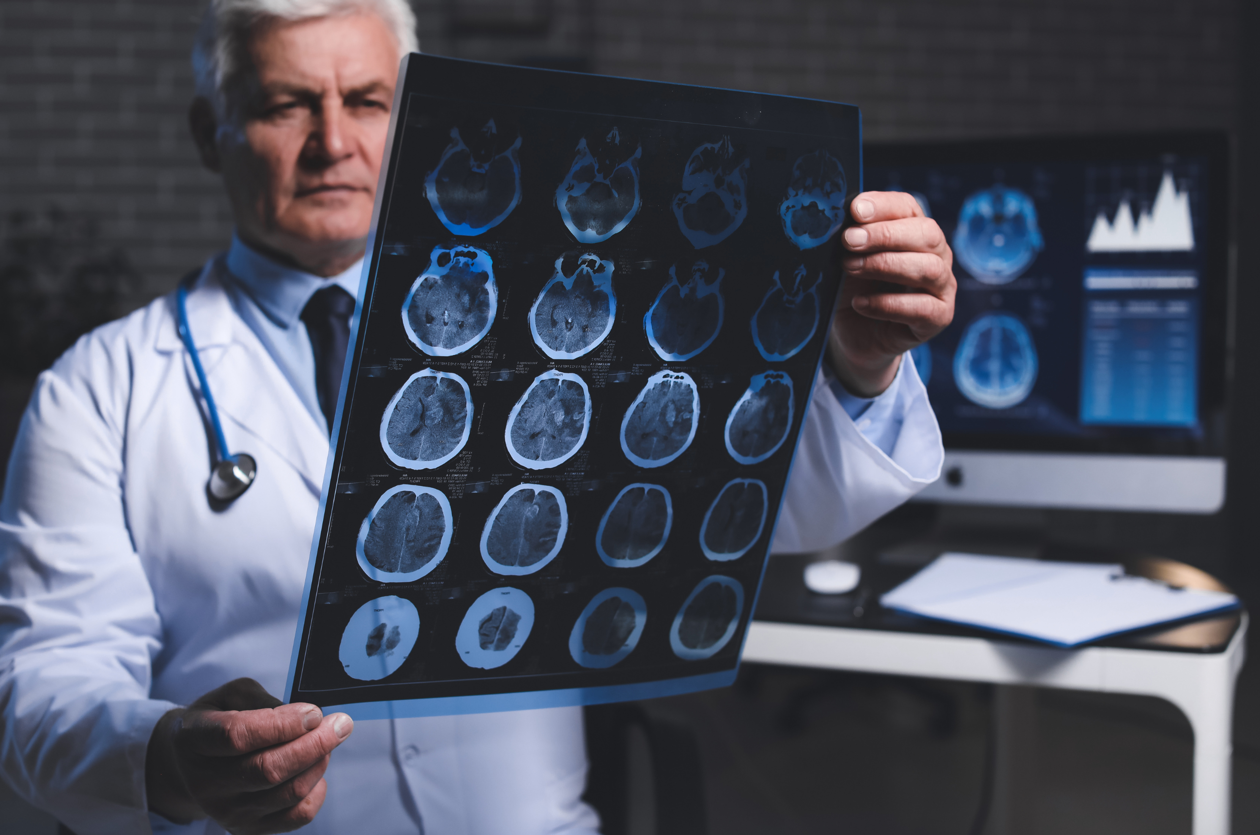 Peptides and Alzheimer's. What the science shows | Ivory