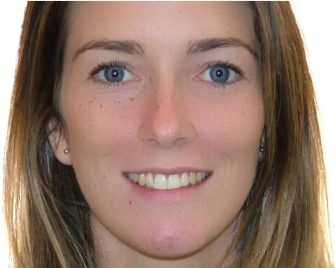 full-month-reconstruction-2