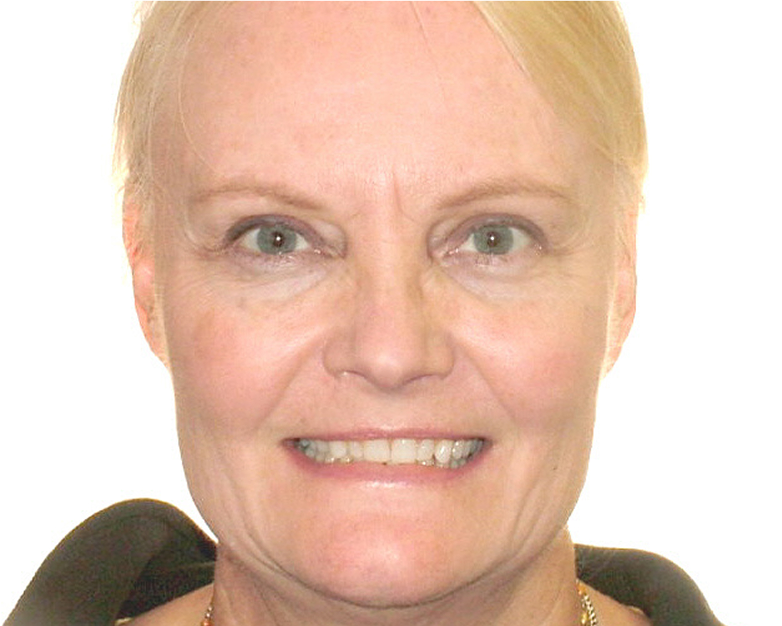 full-month-reconstruction