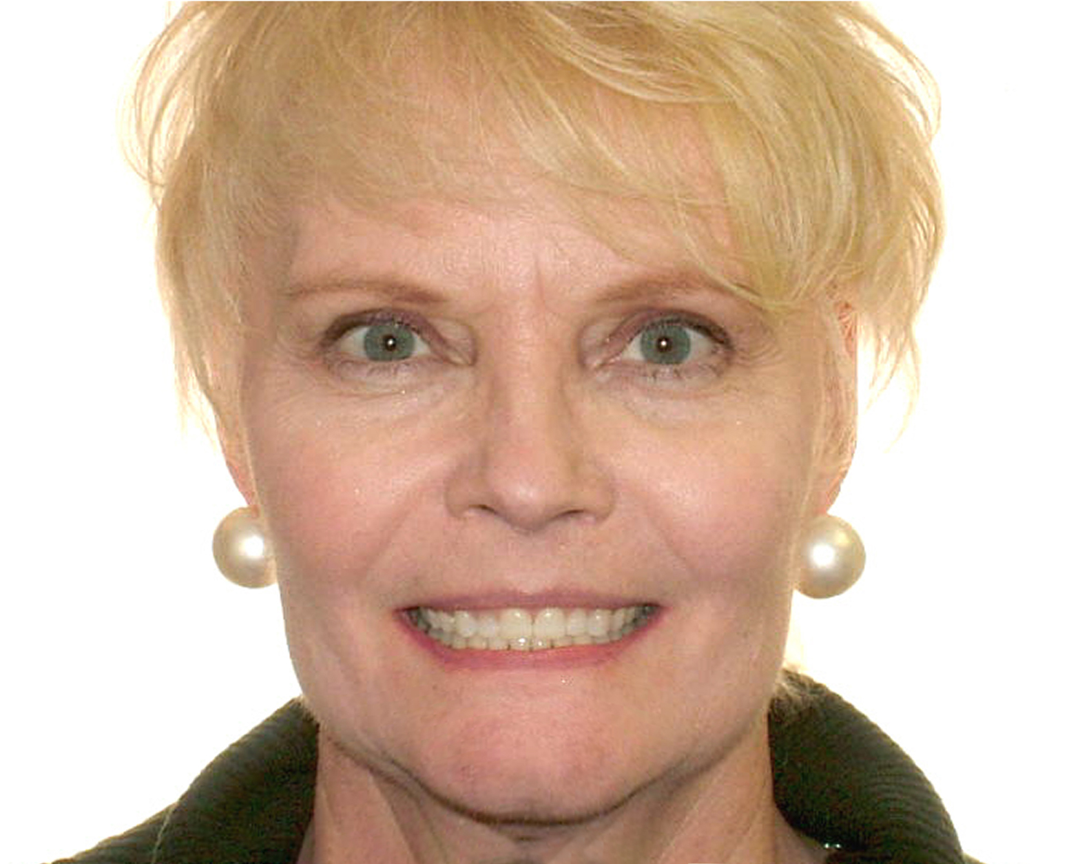 full-month-reconstruction-2