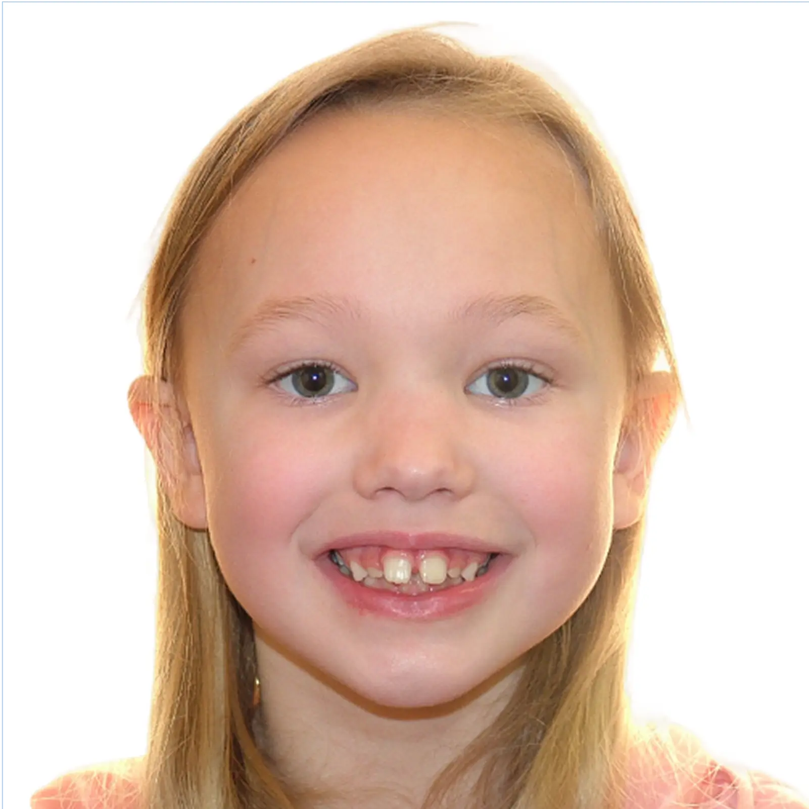 full-month-reconstruction