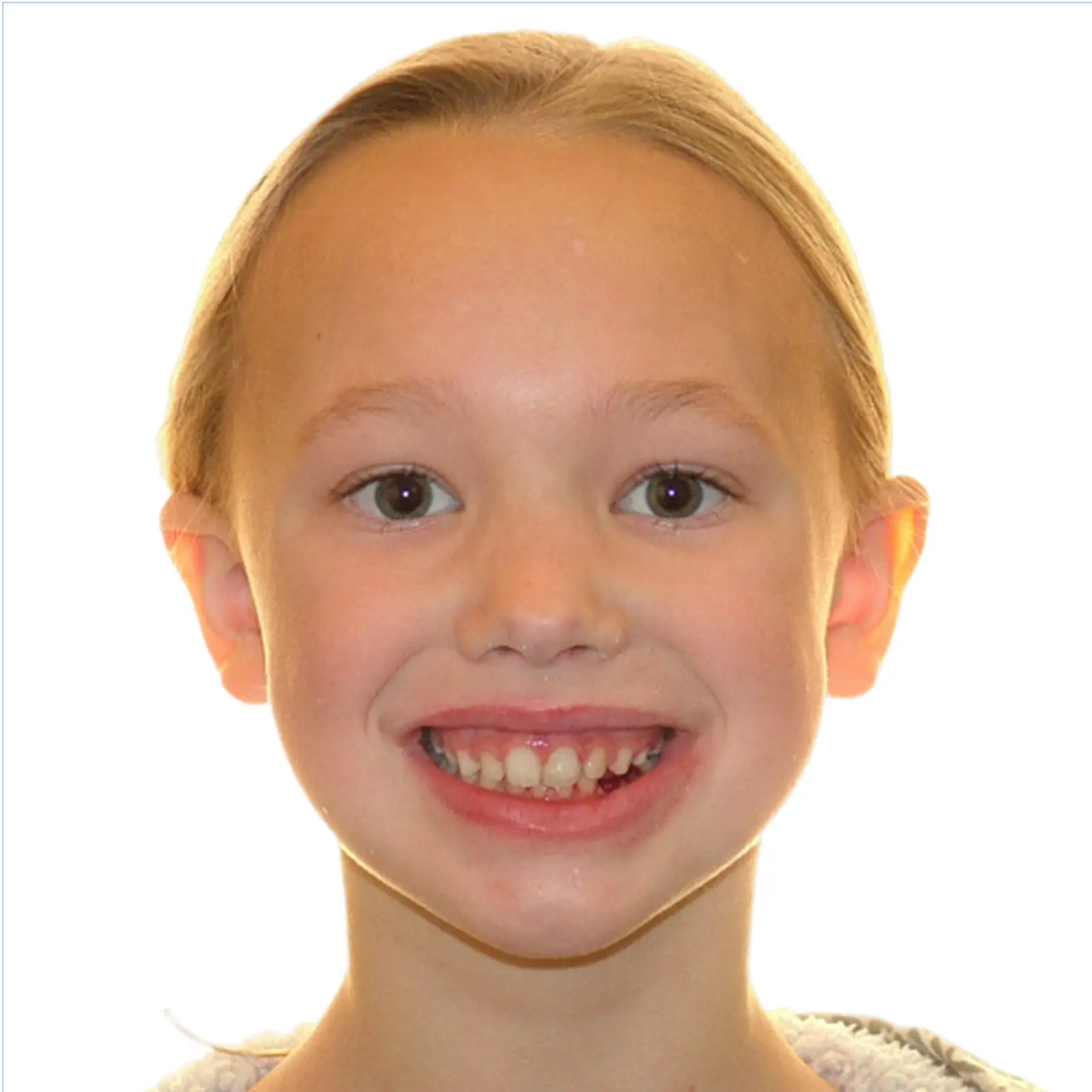 full-month-reconstruction-2