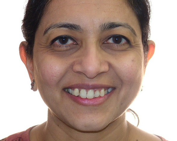 full-month-reconstruction