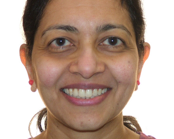 full-month-reconstruction-2