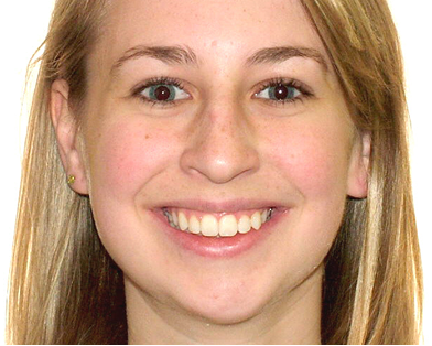 full-month-reconstruction-2