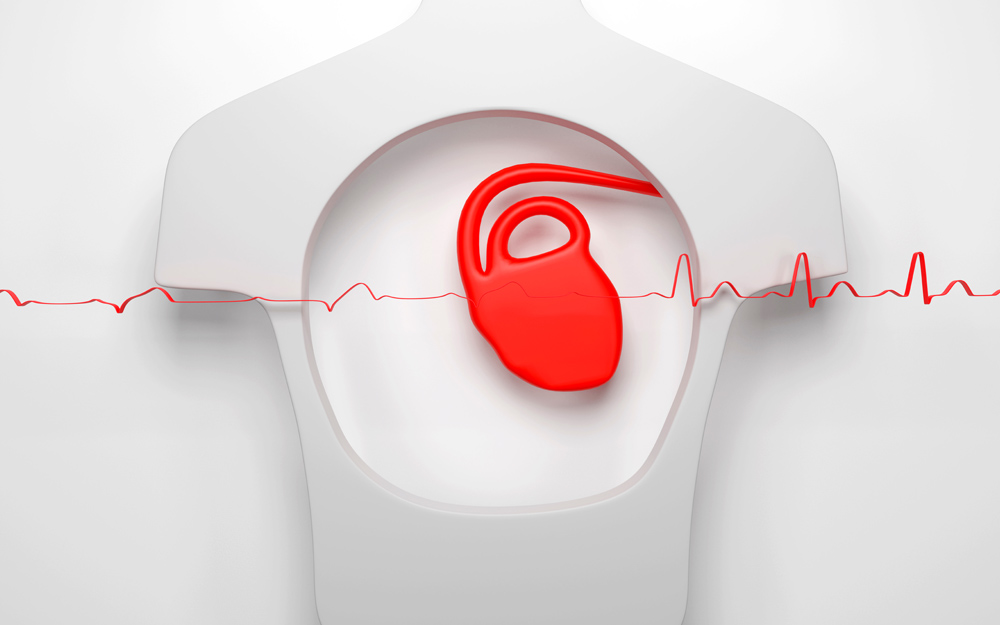 Back Into Rhythm: Adjusting to an AFib Diagnosis