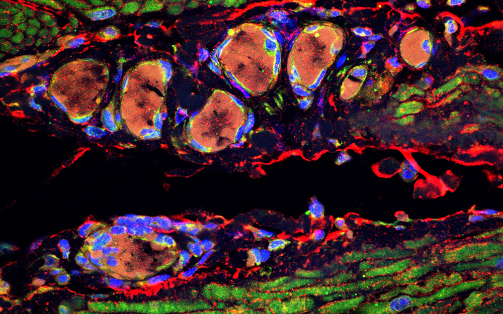 Tummy Troubles: Don't Suffer in Silence with IBS