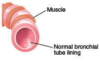 Normal airway and bronchial tube lining