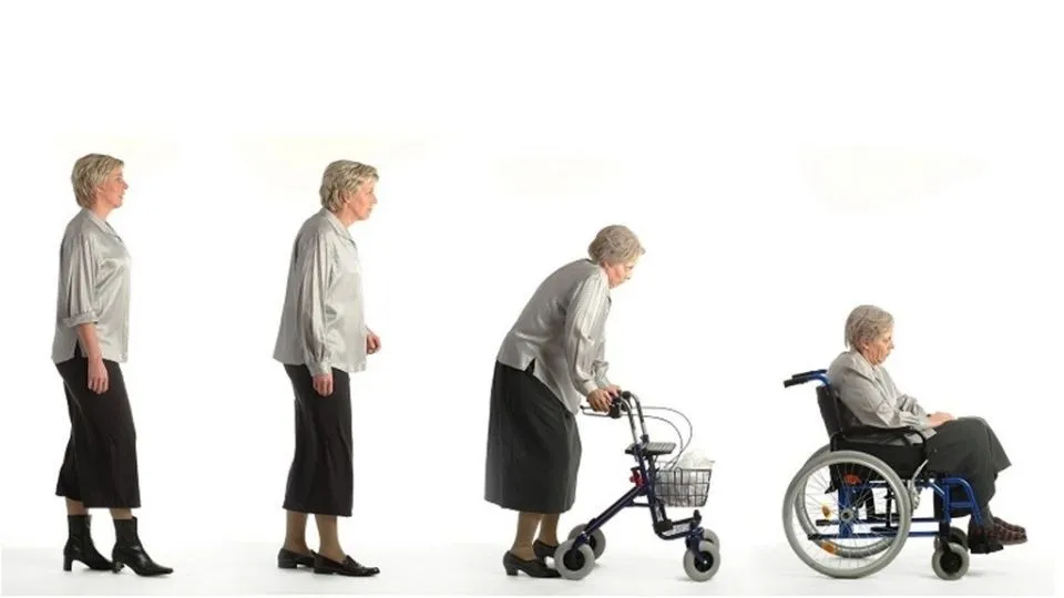 Entwicklung Osteoporose