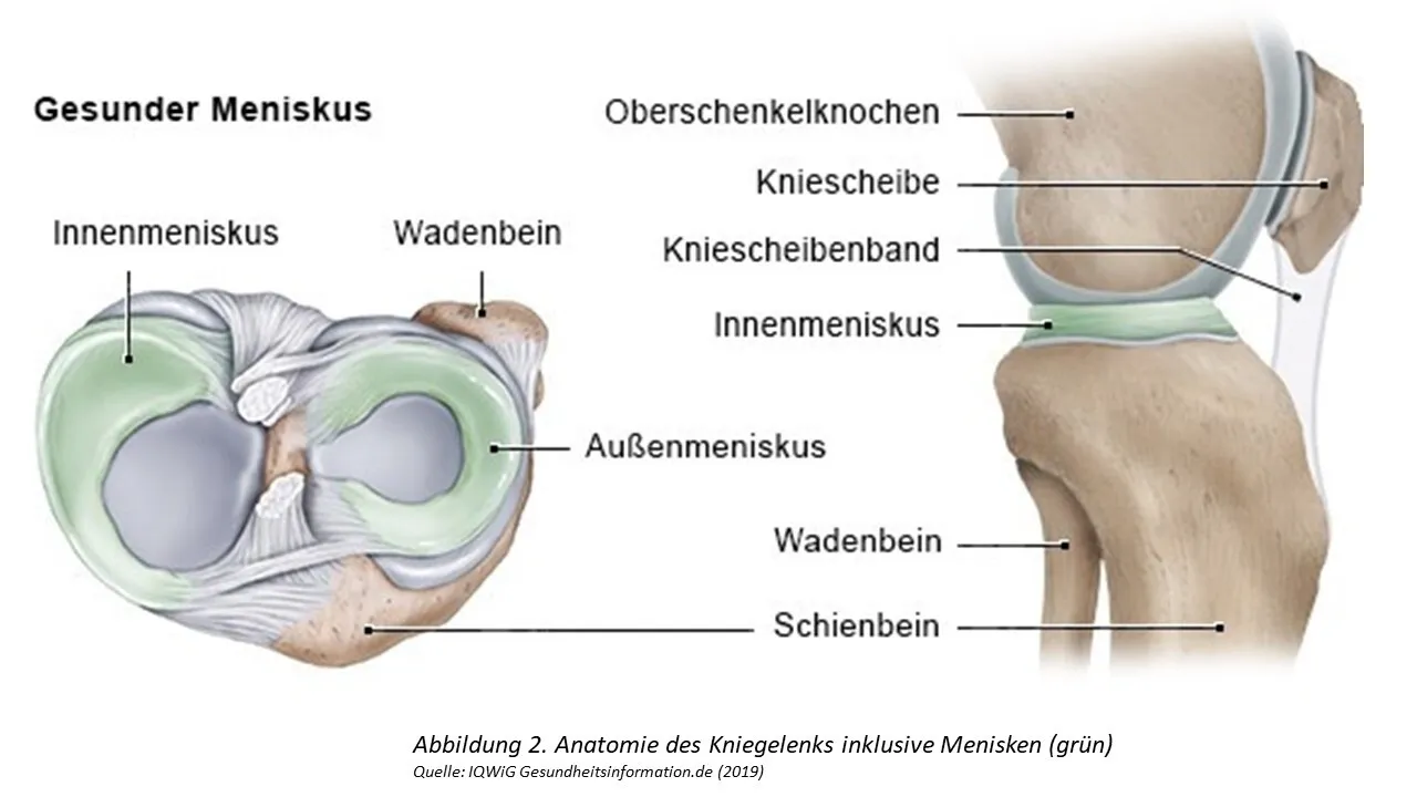 Meniskus Kniegelenk