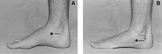navicular-drop-test