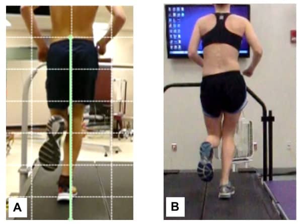 running-analysis-it-band-pain