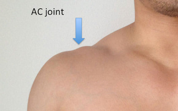 ac-joint-separation
