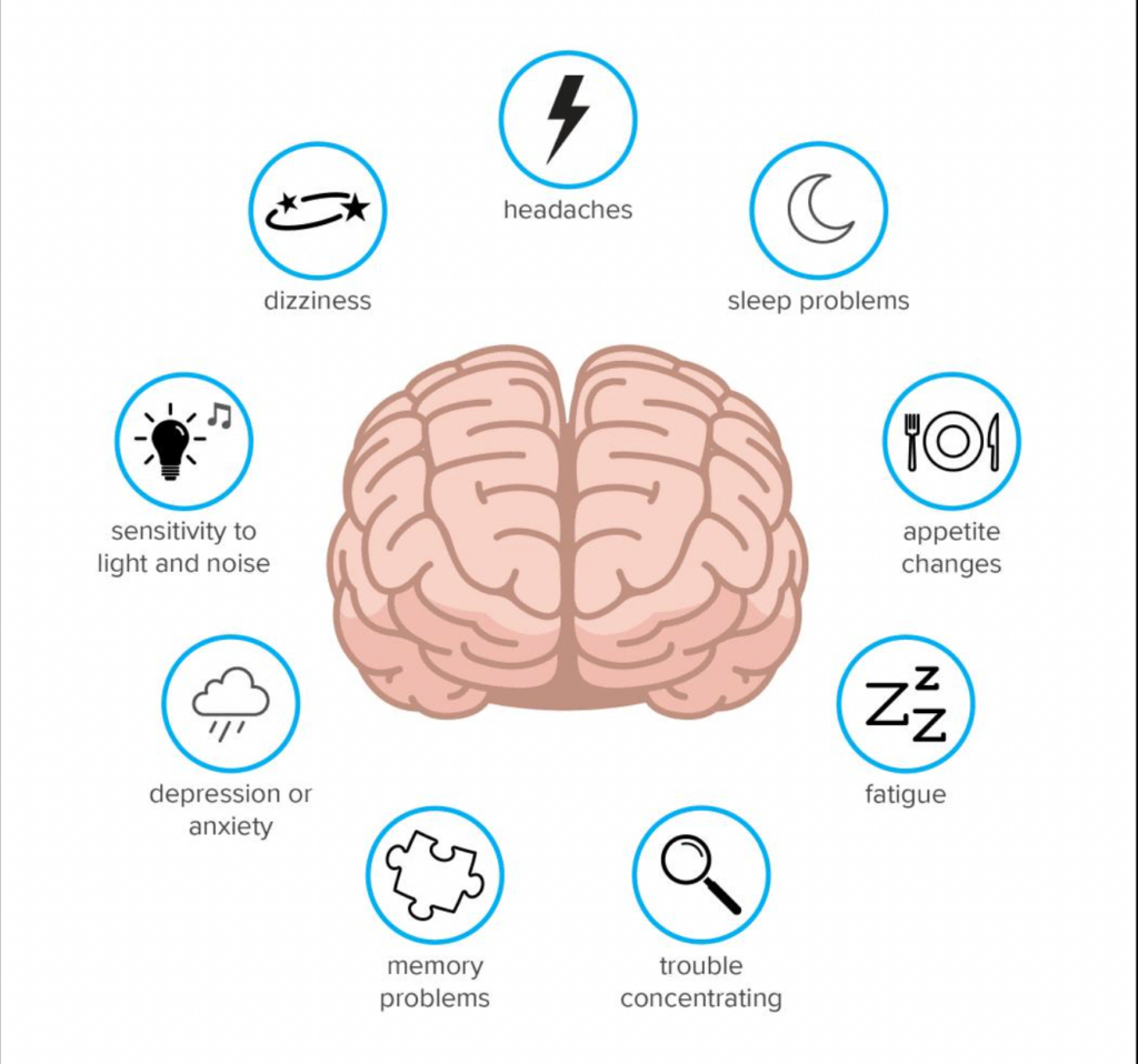 post-concussion-syndrome-signs-and-symptoms-toronto-1024x958