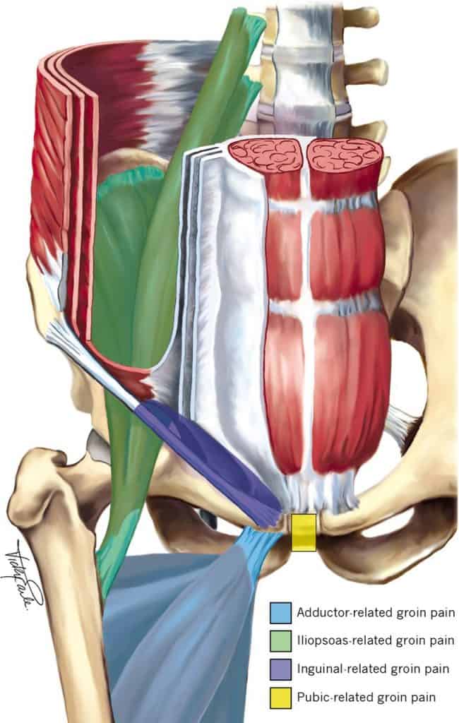 as-related-groin-pain