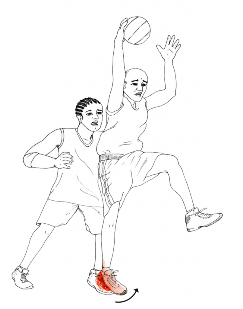 mechanism-of-a-lateral-ankle-sprain-806x1024