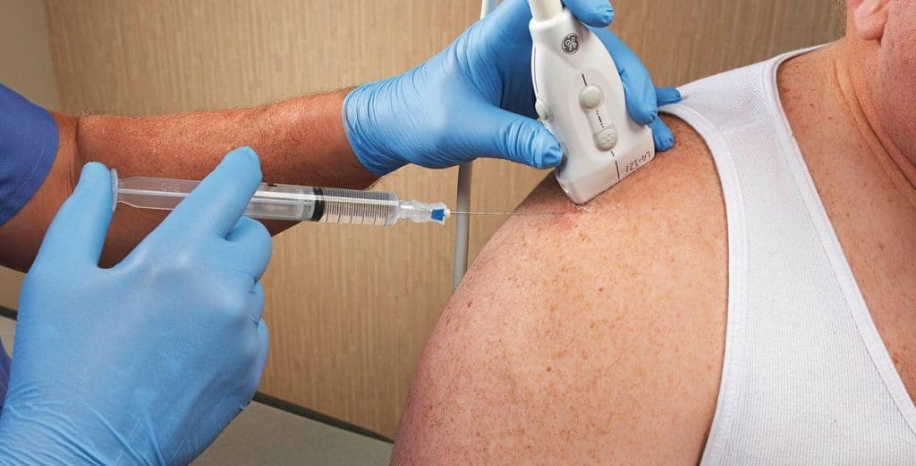 msk-steroid-injection-london-1024x522